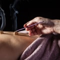 A Complete Overview of Acupuncture and Moxibustion Therapy