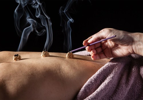 A Complete Overview of Acupuncture and Moxibustion Therapy
