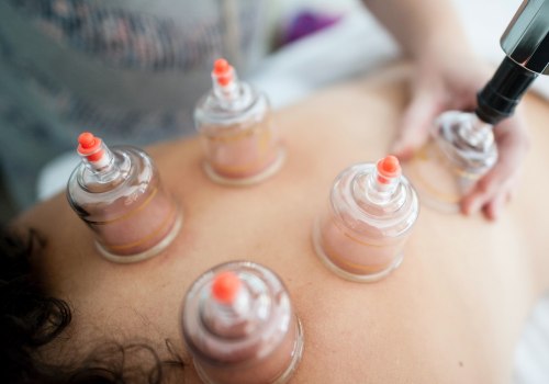 Cupping Therapy for Detoxification: A Natural Solution to Improve Skin, Hair, and Weight Loss